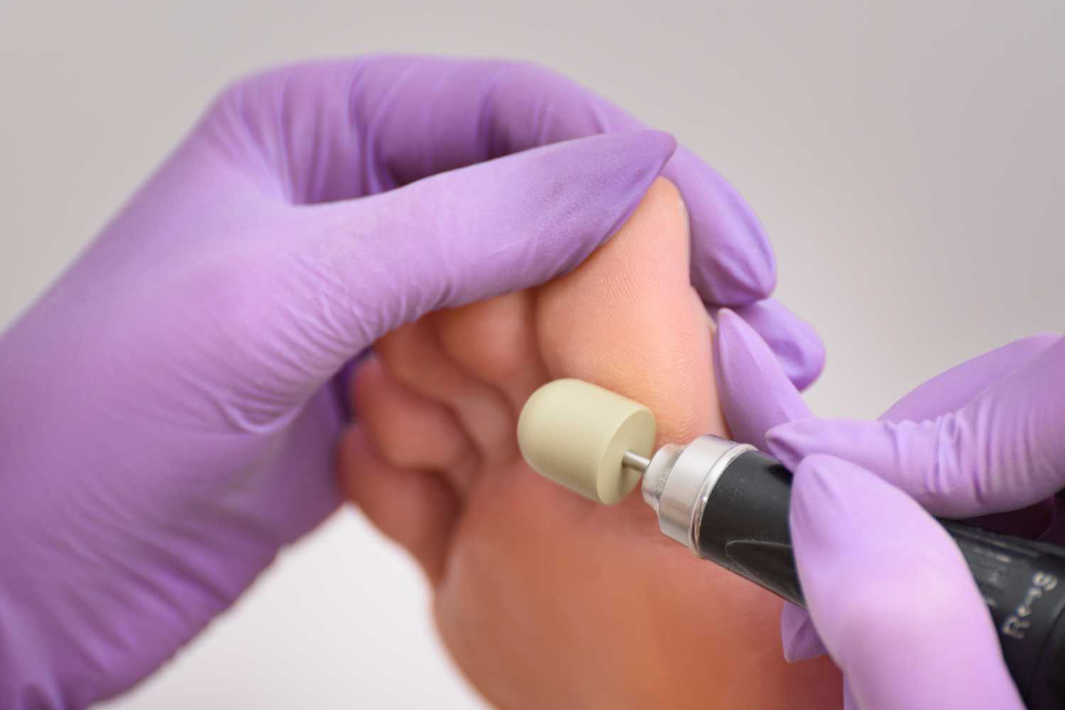 podotherapie in Zoetermeer